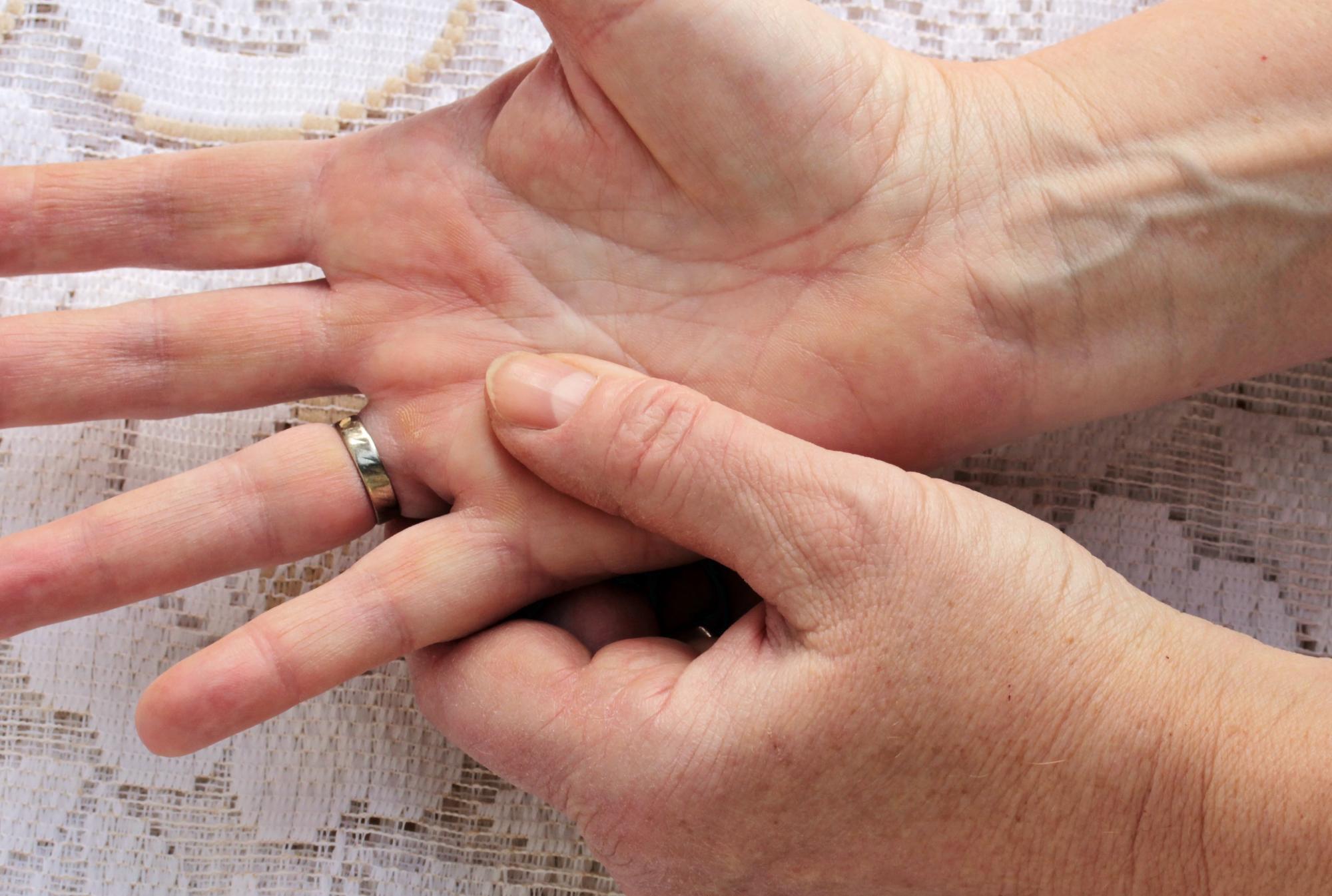 Comment retirer une bague coincée ?